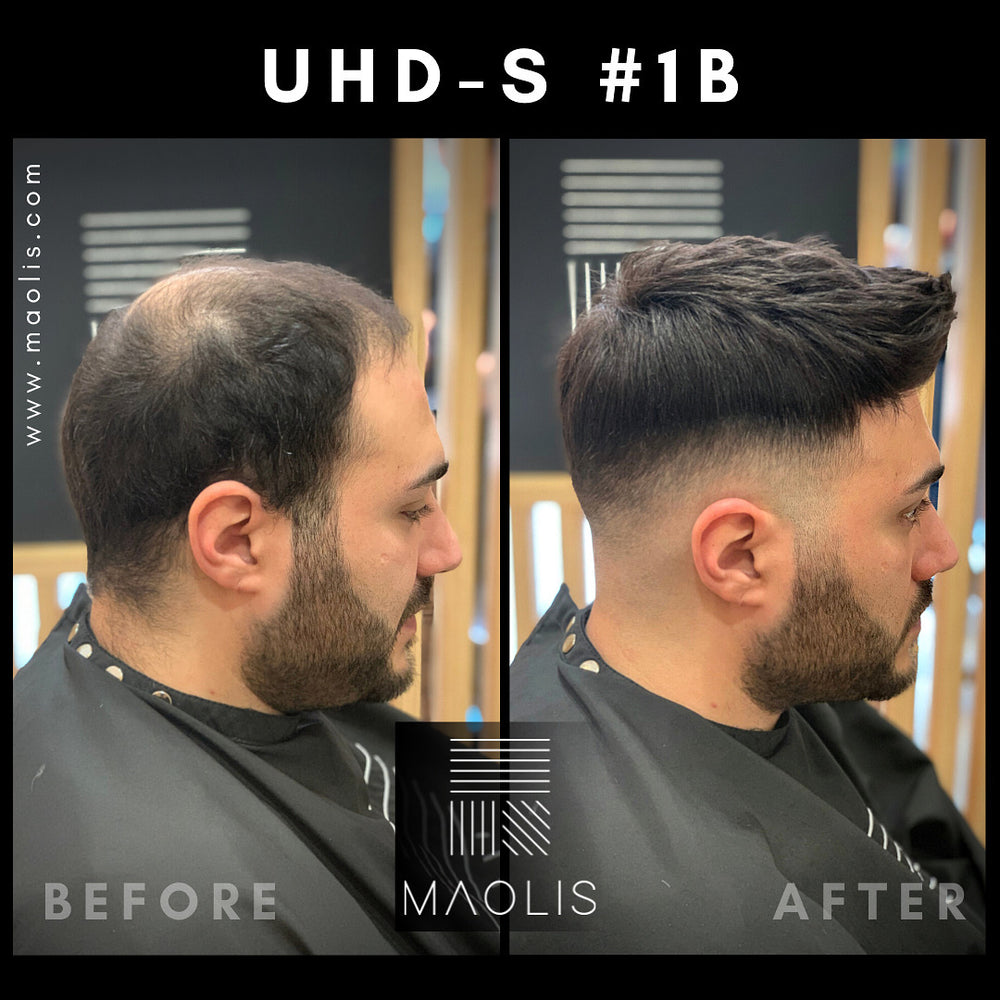 MAOLIS ULTRA HD-S