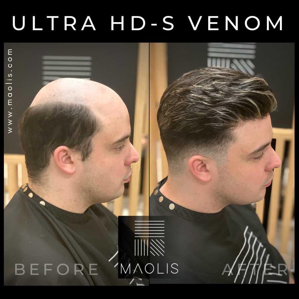 MAOLIS ULTRA HD-S VENOM