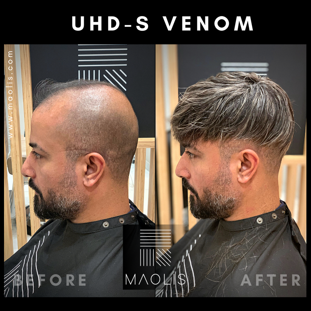 MAOLIS ULTRA HD-S VENOM