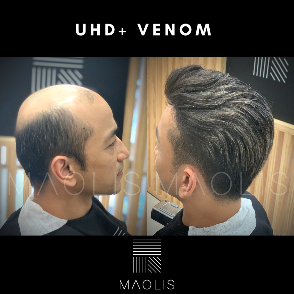 MAOLIS ULTRA HD-S VENOM