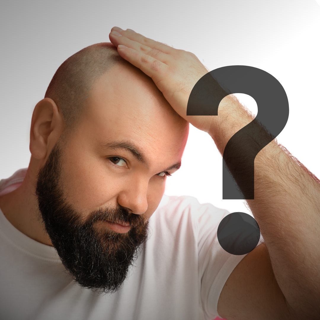 Implants capillaire ou complément capillaire ?