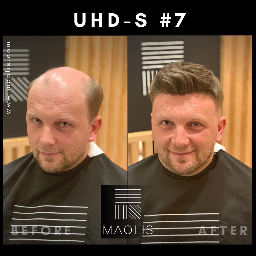 ULTRA HD-S