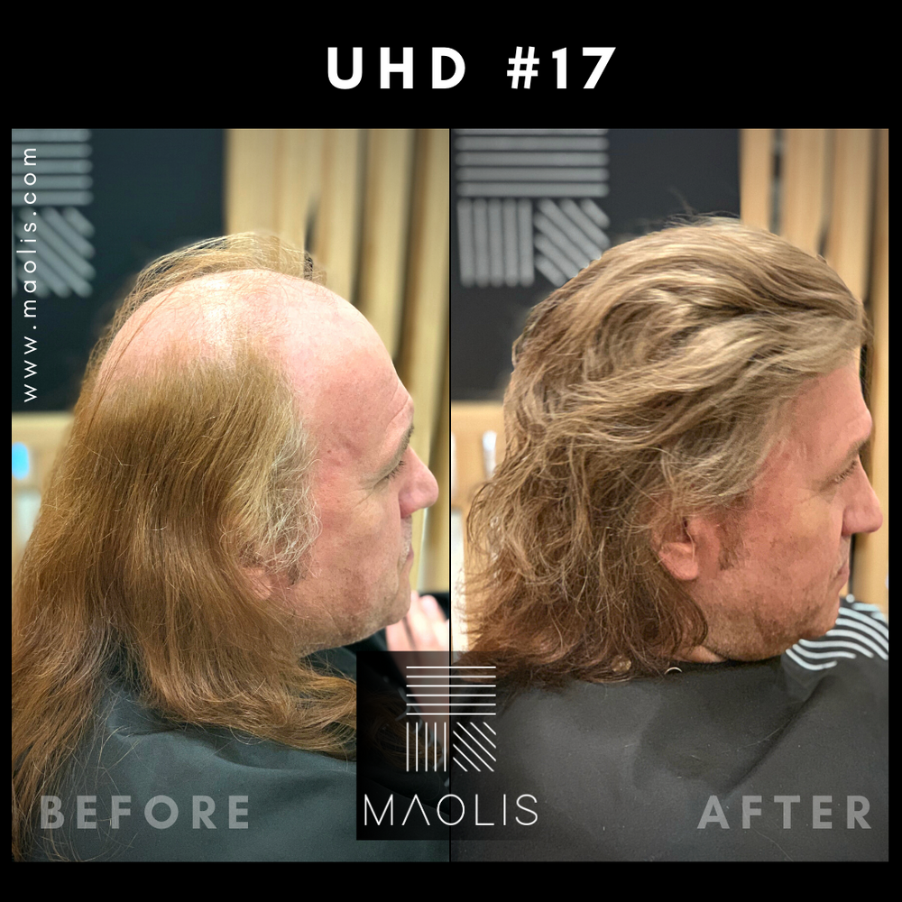 ULTRA-HD