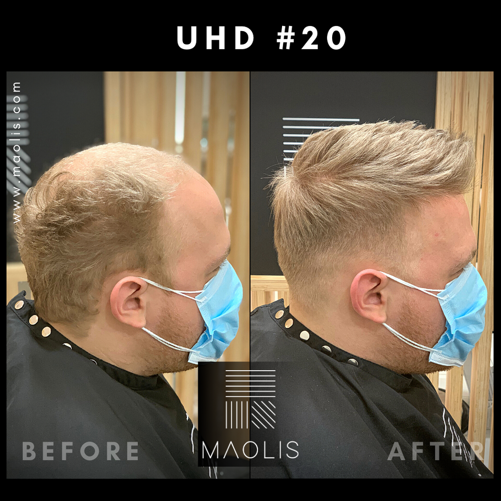 ULTRA-HD