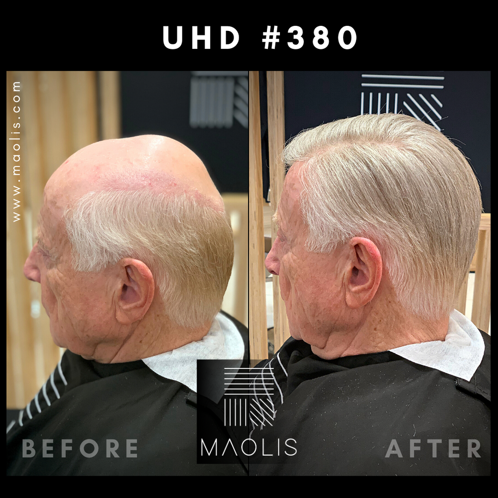 ULTRA-HD