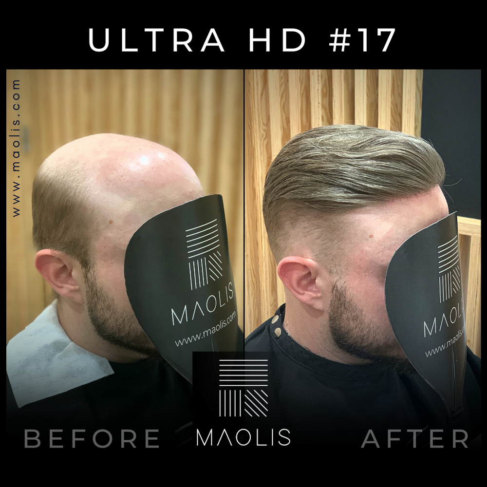 ULTRA-HD